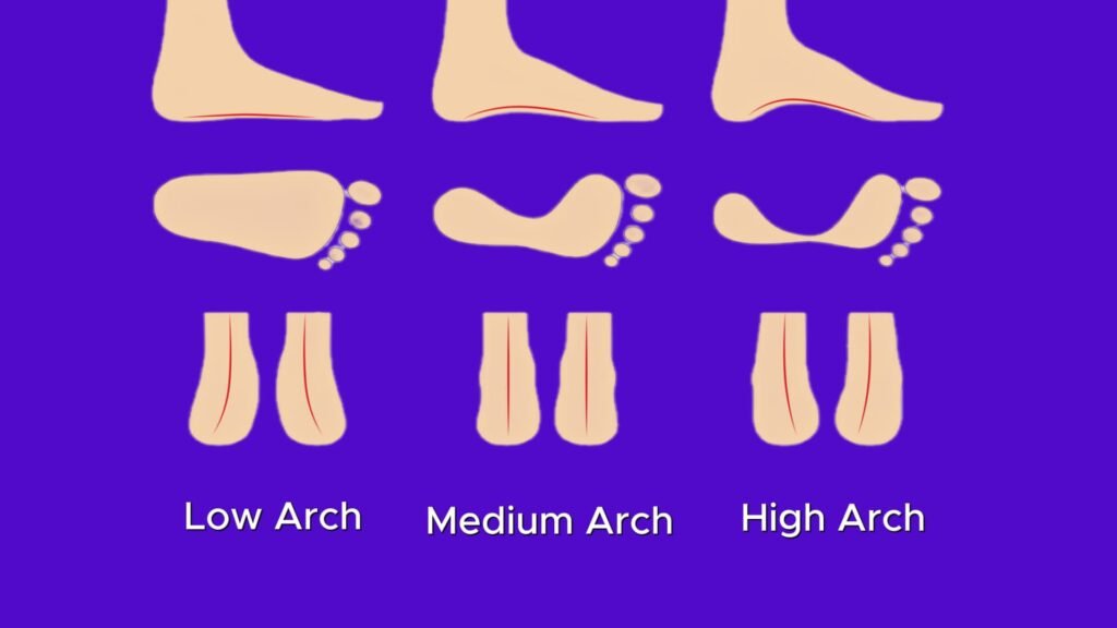 Arch Type