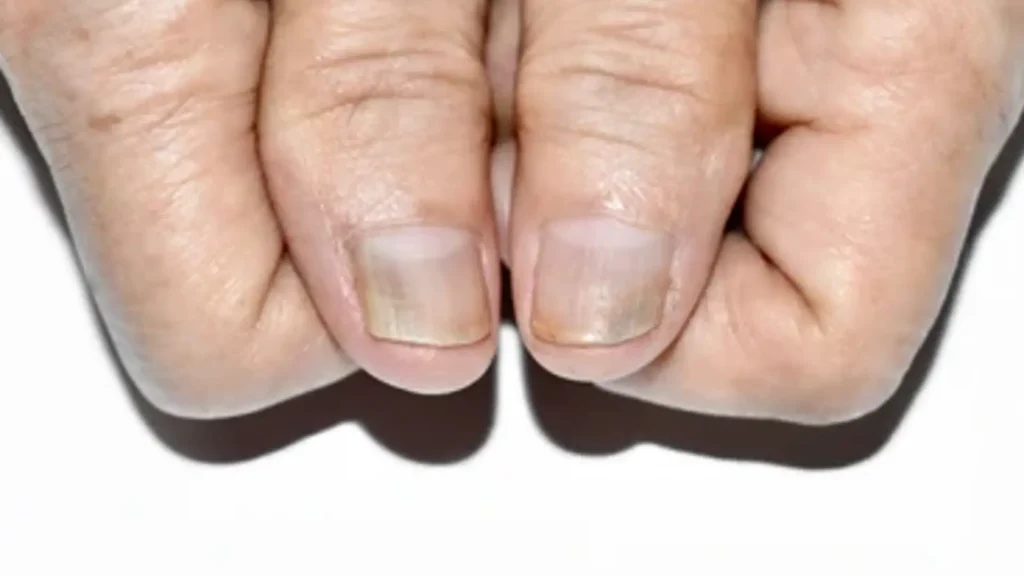 nail care for elderly